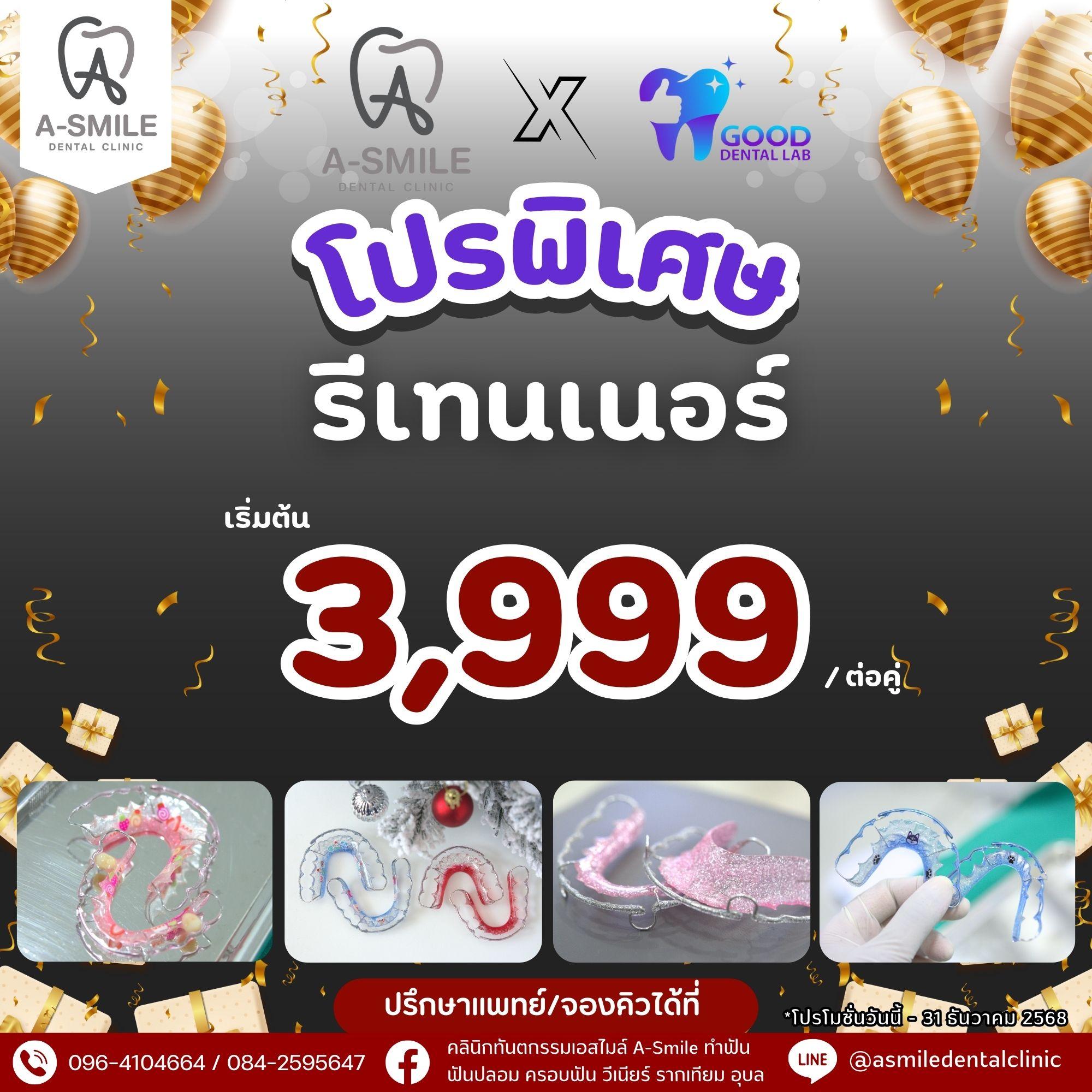 โปรโมชั่น รีเทนเนอร์ คลินิกทันตกรรม เอสไมล์ อุบล
